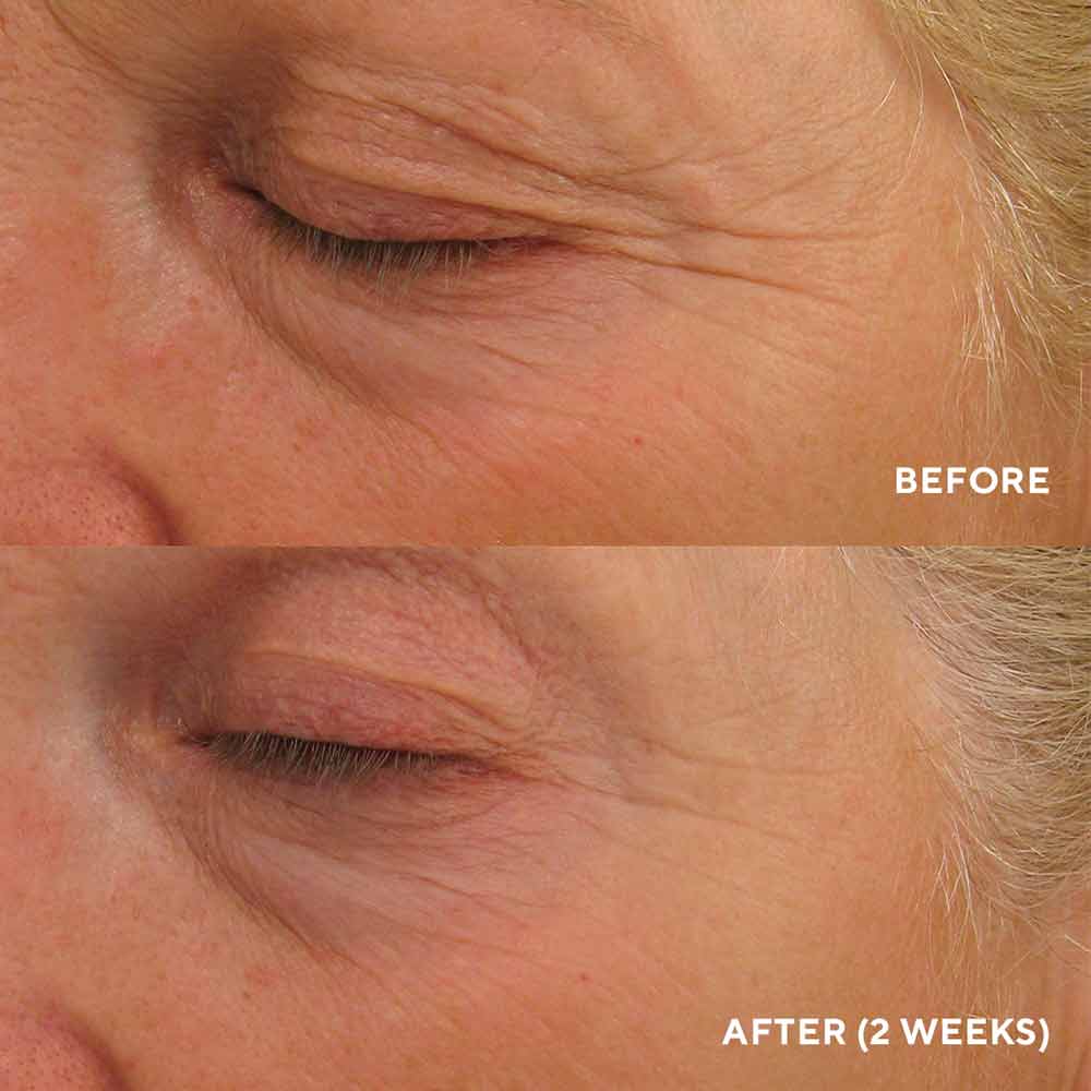 Eye Authority Peptide Eye Cream