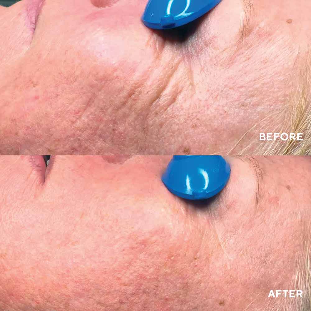 Collagen ReActivate PM