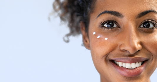 How to Get Rid of Dark Circles and Bags Under Your Eyes