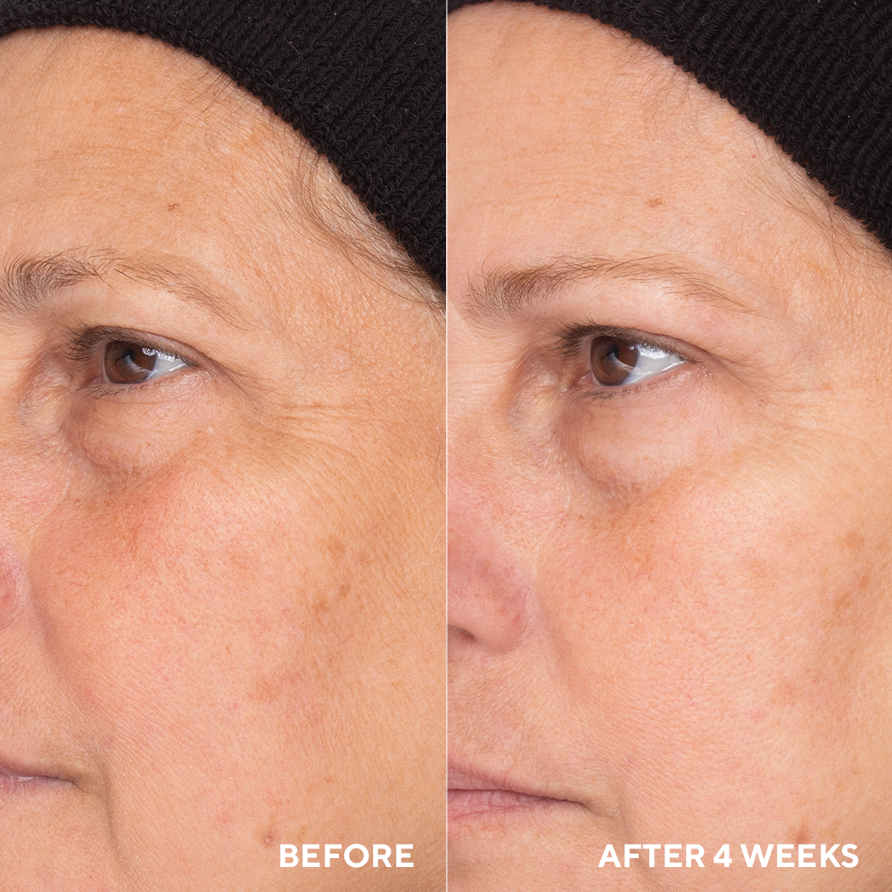 Travel-Size Retinol Routine Booster